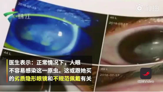 库博隐形眼镜如何辨真假——保障您的眼睛健康与视力安全
