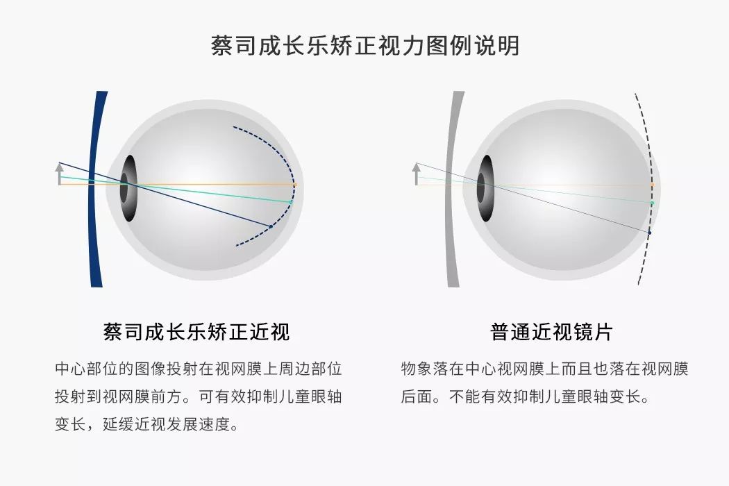 德国蔡司镜片真假分辨指南